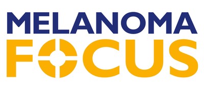 Melanoma Focus